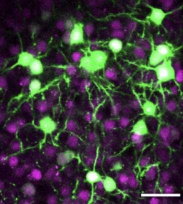 Later EGFP readout: green neurons after targeted recombination in Ai140 reporter mouse neocortex. Ali Cetin, unpublished.