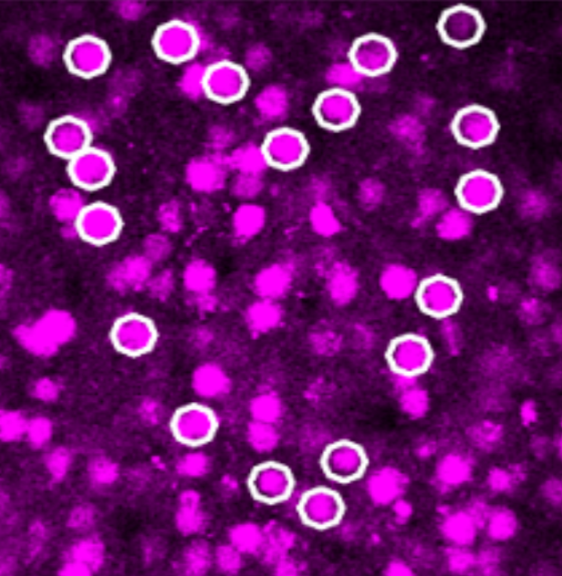 Before conversion: white circles mark target neurons in a heart-shaped pattern among magenta cells.
